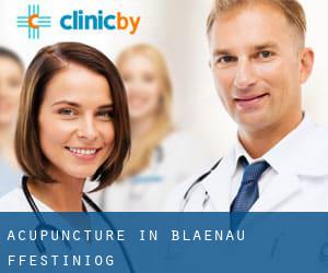 Acupuncture in Blaenau-Ffestiniog