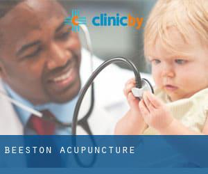 Beeston Acupuncture